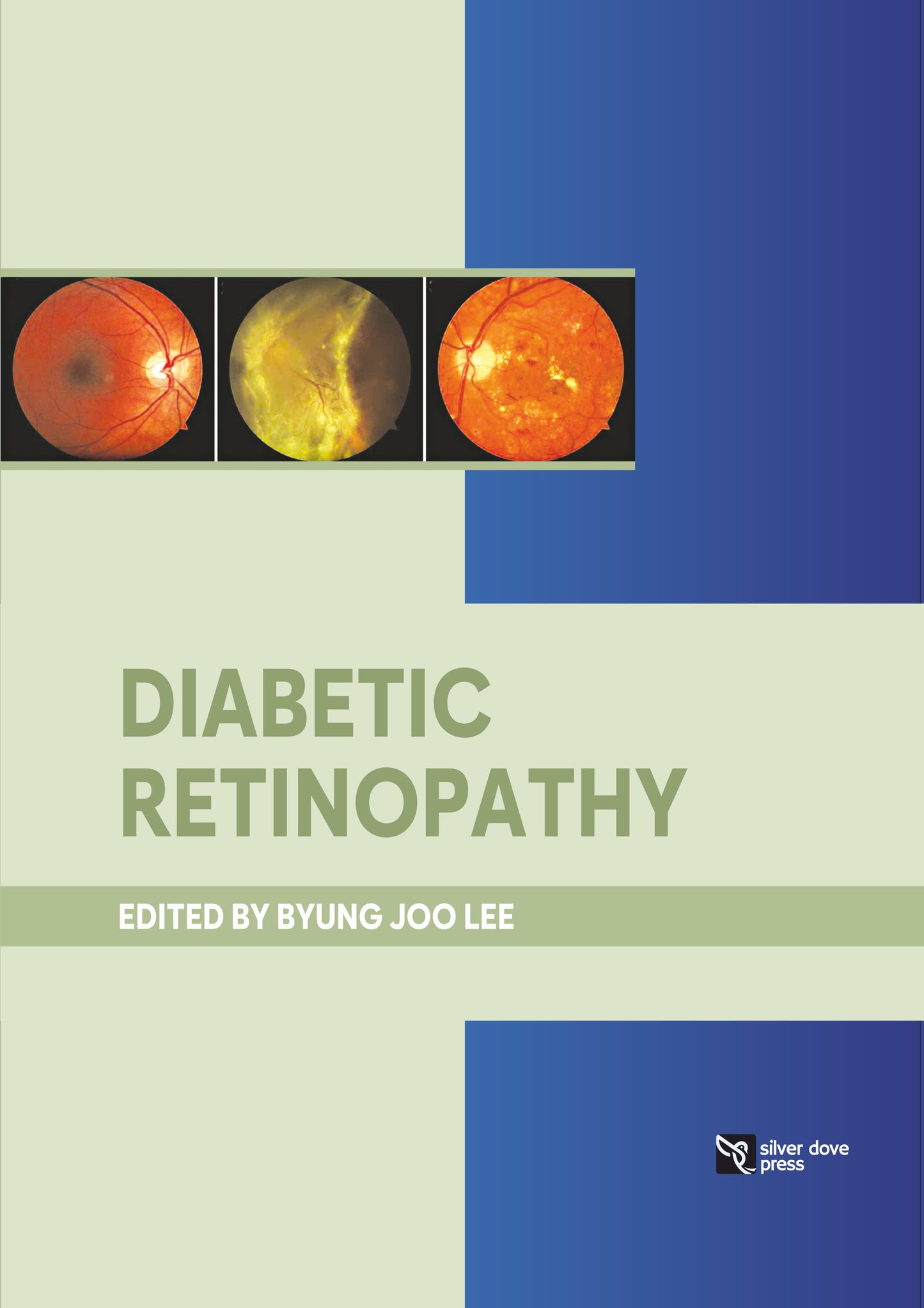 Byung Joo Lee:-Diabetic Retinopathy:2025