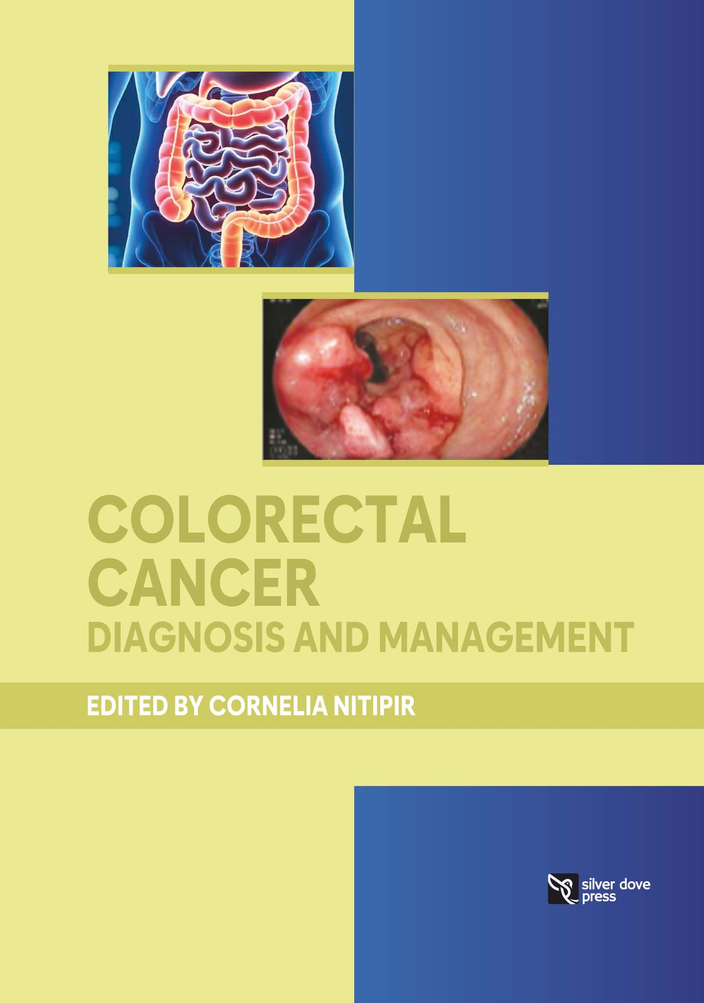 Cornelia Nitipir:-Colorectal Cancer - Diagnosis and management:2025